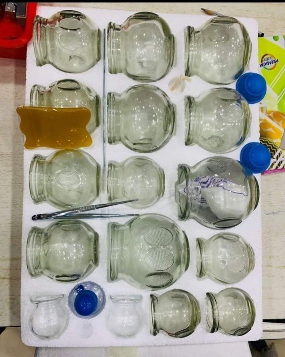 FIRE20CUPPING202499.jpg FIRE CUPPING